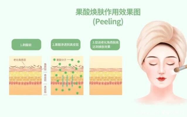 果酸换肤价格深度解析与个人看法