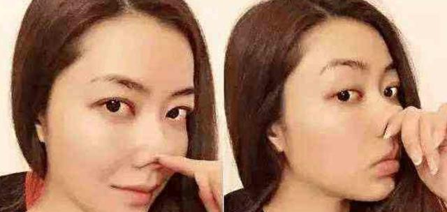 猪鼻子明星，容貌与社会认知的交织影响